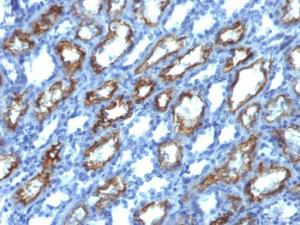 Anti-Interferon gamma Mouse Monoclonal Antibody [clone: IFNG/466]