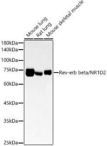 Western blot analysis of extracts of various cell lines, using Anti-RVR Antibody [ARC54887] (A305359) at 1:2,000 dilution The secondary antibody was Goat Anti-Rabbit IgG H&L Antibody (HRP) at 1:10,000 dilution Lysates/proteins were present at 25 µg per lane