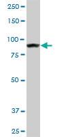 Anti-AMPD2 Mouse Monoclonal Antibody [clone: 2F5]