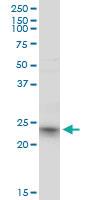 Anti-RRAS2 Mouse Monoclonal Antibody [clone: 2D3-4B8]