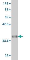 Anti-BLK Mouse Monoclonal Antibody [clone: 7A12]