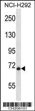 Anti-HIC1 Rabbit Polyclonal Antibody (HRP (Horseradish Peroxidase))