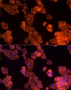 Immunofluorescence analysis of HepG2 cells using Anti-PD-L2 Antibody (A93287) at a dilution of 1:50 (40x lens). DAPI was used to stain the cell nuclei (blue).