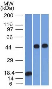 Western blot analysis of (Lane 1) recombinant alpha 1 Antitrypsin, (Lane 2) Jurkat cell lysate, and (Lane 3) A549 cell lysate using Anti-alpha 1 Antitrypsin Antibody [AAT/1378]