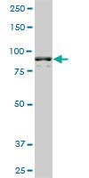 Anti-AMPD2 Mouse Monoclonal Antibody [clone: 2F5]