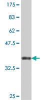 Anti-ATP6V1D Mouse Polyclonal Antibody