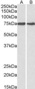 Anti-HSPA5 antibody