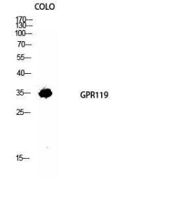 Western blot analysis of COLO cells using Anti-GPR119 Antibody