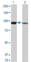 Anti-AMPD2 Mouse Monoclonal Antibody [clone: 2F5]