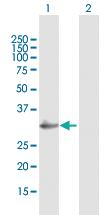 Anti-VWF Mouse Polyclonal Antibody