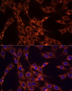 Immunofluorescence analysis of NIH/3T3 cells using Anti-PD-L2 Antibody (A93287) at a dilution of 1:50 (40x lens). DAPI was used to stain the cell nuclei (blue).