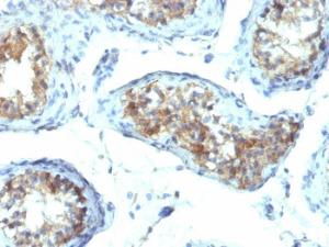 Anti-Interferon gamma Mouse Monoclonal Antibody [clone: IFNG/466]