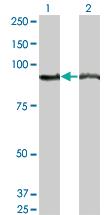 Anti-AMPD2 Mouse Monoclonal Antibody [clone: 2G8]