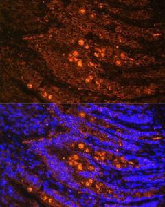 Immunofluorescence analysis of rat Intestine using Anti-Talin 1 Antibody (A9389) at a dilution of 1:100. DAPI was used to stain the cell nuclei (blue)