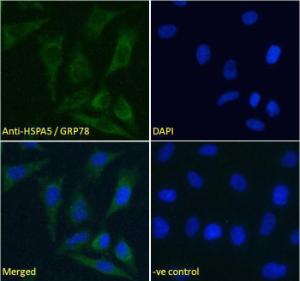 Anti-HSPA5 antibody