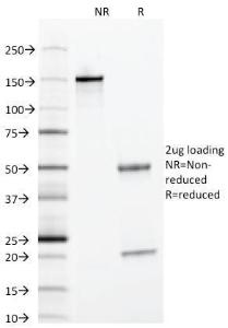 SDS-PAGE analysis of Anti-alpha 1 Antitrypsin Antibody [AAT/1378] under non-reduced and reduced conditions; showing intact IgG and intact heavy and light chains, respectively. SDS-PAGE analysis confirms the integrity and purity of the Antibody