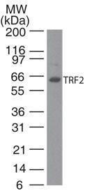 Anti-TERF2 Mouse Monoclonal Antibody [clone: 4A794.15]