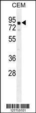 Anti-GLB1L2 Rabbit Polyclonal Antibody (PE (Phycoerythrin))