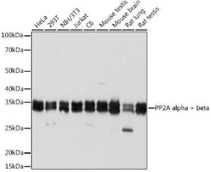 Western blot analysis of extracts of various cell lines, using Anti-PP2A-alpha + PPP2CB Antibody [ARC1889] (A309172) at 1:1,000 dilution The secondary antibody was Goat Anti-Rabbit IgG H&L Antibody (HRP) at 1:10,000 dilution Lysates/proteins were present at 25 µg per lane