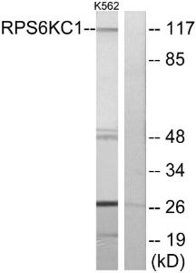 Western blot analysis of lysates from K562 cells using Anti-RPS6KC1 Antibody. The right hand lane represents a negative control, where the antibody is blocked by the immunising peptide.