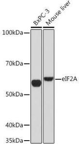 Western blot analysis of extracts of various cell lines, using Anti-eIF2A Antibody [ARC1712] (A305361) at 1:1,000 dilution The secondary antibody was Goat Anti-Rabbit IgG H&L Antibody (HRP) at 1:10,000 dilution Lysates/proteins were present at 25 µg per lane