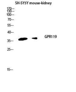 Western blot analysis of SH SY5Y mouse kidney lysis using Anti-GPR119 Antibody