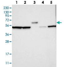 Anti-SDAD1 Rabbit Polyclonal Antibody