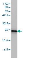 Anti-RRAS2 Mouse Monoclonal Antibody [clone: 2D3-4B8]