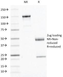 Anti-Interferon gamma Mouse Monoclonal Antibody [clone: IFNG/466]