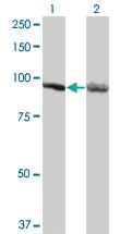 Anti-AMPD2 Mouse Monoclonal Antibody [clone: 3C5]