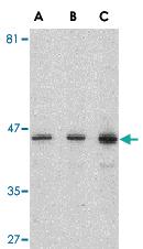 Anti-PSEN1 Rabbit Polyclonal Antibody