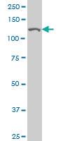 Anti-CAND1 Mouse Monoclonal Antibody [clone: 4D10]