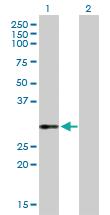 Anti-VWF Rabbit Polyclonal Antibody