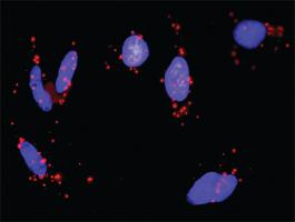 Anti-MAP3K3 + PRKACA Antibody Pair