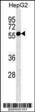 Anti-CASP8 Mouse Monoclonal Antibody [clone: 550CT8.5.2]