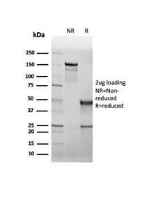 SDS-PAGE analysis of Anti-CFTR Antibody [rCFTR/6476] under non-reduced and reduced conditions; showing intact IgG and intact heavy and light chains, respectively. SDS-PAGE analysis confirms the integrity and purity of the antibody.