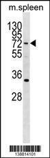 Anti-HIC2 Rabbit Polyclonal Antibody (APC (Allophycocyanin))