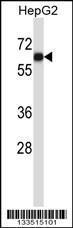 Anti-AMIGO1 Rabbit Polyclonal Antibody (HRP (Horseradish Peroxidase))