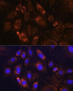 Immunofluorescence analysis of C6 cells using Anti-PDE12 Antibody (A93288) at a dilution of 1:100. DAPI was used to stain the cell nuclei (blue).