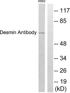 Antibody anti-desmin A95627-100 100 µg