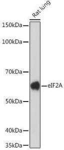 Western blot analysis of extracts of Rat lung, using Anti-eIF2A Antibody [ARC1712] (A305361) at 1:1,000 dilution The secondary antibody was Goat Anti-Rabbit IgG H&L Antibody (HRP) at 1:10,000 dilution Lysates/proteins were present at 25 µg per lane