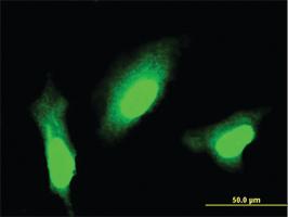 Anti-MSI1 Mouse Monoclonal Antibody [clone: 4A11]