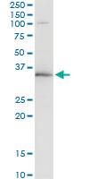 Anti-WBSCR22 Mouse Monoclonal Antibody [clone: 2E12]