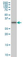 Anti-TSSK6 Mouse Monoclonal Antibody [clone: 6F5]