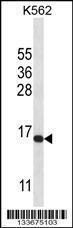 Anti-H2AFX Rabbit Polyclonal Antibody (FITC (Fluorescein Isothiocyanate))