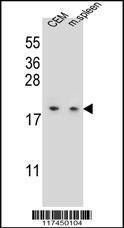 Anti-LSM7 Rabbit Polyclonal Antibody (FITC (Fluorescein Isothiocyanate))