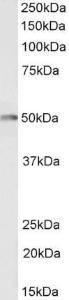 Anti-CSK Antibody (A83597 / Biotin) (0.5µg/ml) staining of Jurkat lysate (35µg protein in RIPA buffer), exactly mirroring its parental non-biotinylated product. Primary incubation was 1 hour.