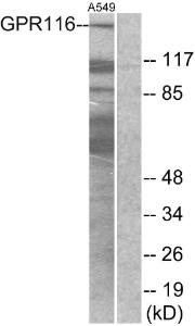 Antibody anti-GPR116 A99569-100 100 µg