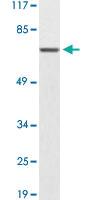 Anti-UMOD Rabbit Polyclonal Antibody