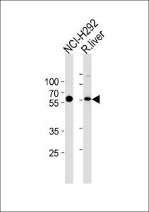 Anti-MCCC2 Rabbit Polyclonal Antibody